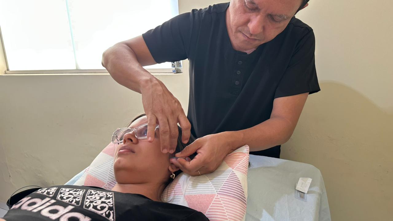Coronel Mota oferece tratamento com acupuntura para pacientes com DTM   