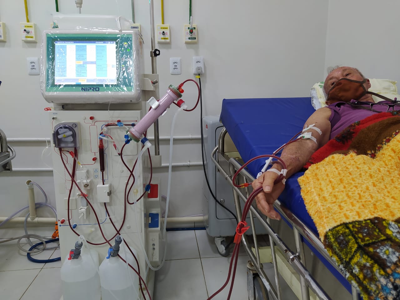 Sesau inicia novo fluxo de atendimento de pacientes renais crônicos